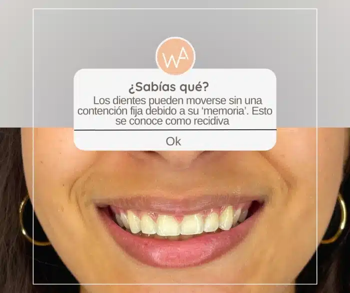 Dientes se movieron despues de la ortodoncia