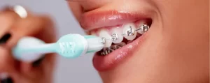 como limpiarse los dientes con ortodoncia