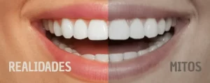 mitos de la ortodoncia