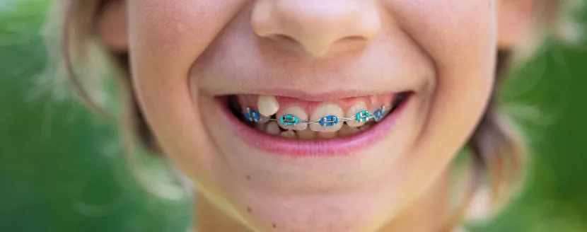 los primeros brackets